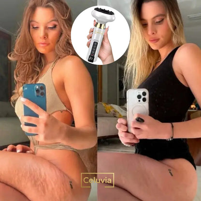Celuvia™ Massageador Anticelulite